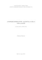 prikaz prve stranice dokumenta Atopijski dermatitis - klinička slika i njega kože